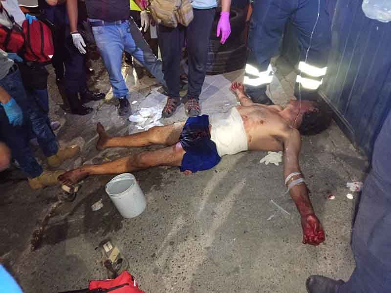 Brutal asalto (3)