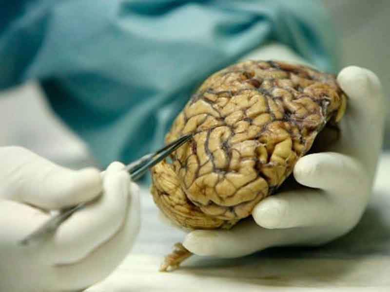 DICU_31 EL CEREBRO