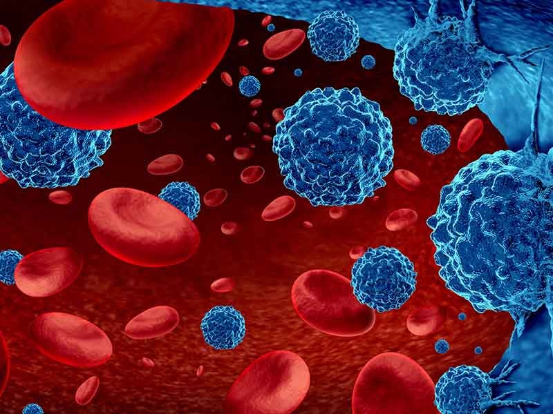Cancer in the blood outbreak and treatment for malignant cells in a human body caused by carcinogens and genetics with a cancerous cell as an immunotherapy and leukemia or lymphoma symbol and medical therapy as a 3D render.